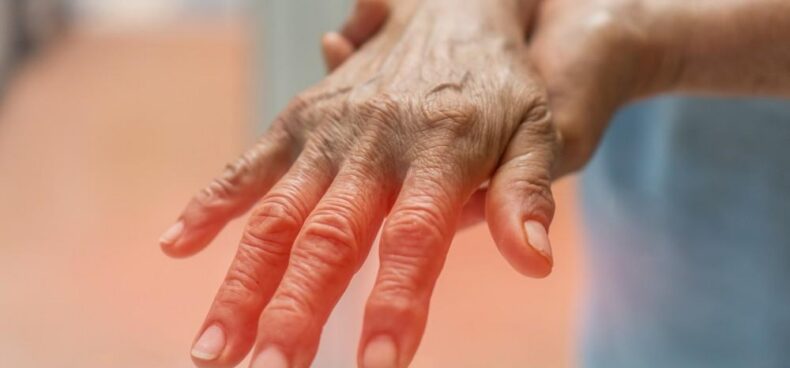 Peripheral Neuropathy